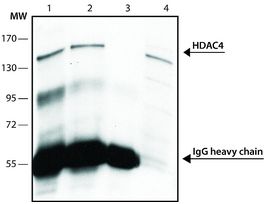 Anti-Histone Deacetylase 4 (HDAC4) (DM-15) antibody produced in rabbitaffinity isolated antibody, buffered aqueous solution