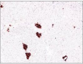 Monoclonal Anti-Insulin antibody produced in mouseclone K36AC10, ascites fluid 100UL