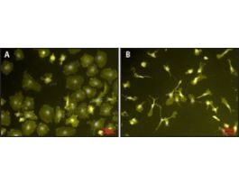 Lipopolysaccharides from Escherichia coli 0111:B4purified by phenol extraction 100MG