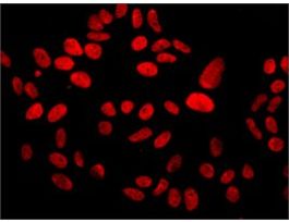 Monoclonal Anti-MDC1 antibody produced in mouseclone MDC1-50, purified immunoglobulin, buffered aqueous solution 200UL