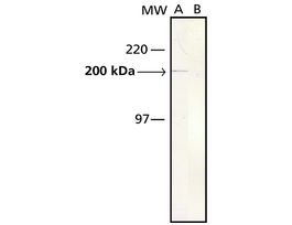 Monoclonal Anti-Myosin (Skeletal, Slow) antibody produced in mouseclone NOQ7.5.4D, ascites fluid 100UL