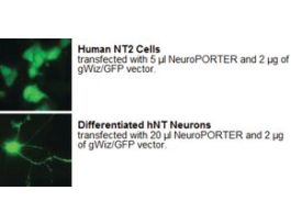NeuroPorter(TM) Transfection KitLipid formulation for nucleic acid transfections in neuronal and glial cells