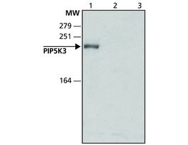 Anti-PIP5K3 (N-terminal) antibody produced in rabbit~1.5 mg/mL, affinity isolated antibody, buffered aqueous solution