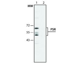 Anti-Phosphatidylserine Receptor antibody produced in rabbit1-1.5 mg/mL, affinity isolated antibody, buffered aqueous solution