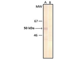 Monoclonal Anti-Phosphoserine antibody produced in mouseclone PSR-45, ascites fluid .2ML