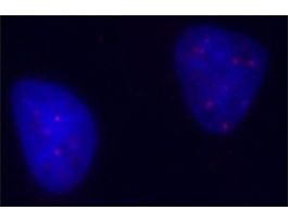 Monoclonal Anti-PML antibody produced in mouseclone PML-97, purified immunoglobulin, buffered aqueous solution