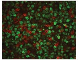 Monoclonal Anti-Proliferating Cell Nuclear Antigen antibody produced in mouseclone PC 10, ascites fluid .2ML