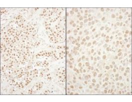 Rabbit anti-BRG1/SMARCA4 Antibody, Affinity PurifiedPowered by Bethyl Laboratories, Inc.