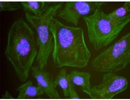 Rabbit anti-G3BP1 Antibody, Affinity PurifiedPowered by Bethyl Laboratories, Inc.