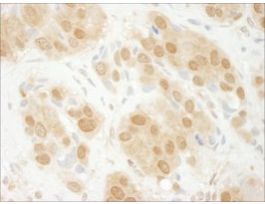 Rabbit anti-ERK1 Antibody, Affinity PurifiedPowered by Bethyl Laboratories, Inc.