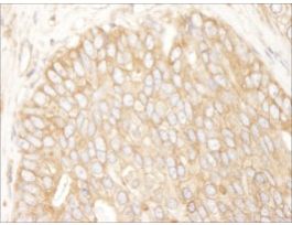 Mouse anti-Rictor Monoclonal Antibody, Affinity PurifiedPowered by Bethyl Laboratories, Inc.