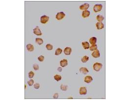 Anti-DCR2 antibody produced in rabbitaffinity isolated antibody, buffered aqueous solution