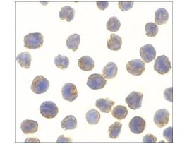 Anti-NAK antibody produced in rabbitaffinity isolated antibody, buffered aqueous solution