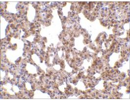 Anti-TRPC6 (ab1) antibody produced in rabbitaffinity isolated antibody, buffered aqueous solution