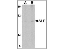 Anti-SLPI (ab2) antibody produced in rabbitaffinity isolated antibody, buffered aqueous solution