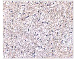Anti-Nhe-1 (ab2) antibody produced in rabbitaffinity isolated antibody, buffered aqueous solution