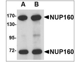 Anti-NUP160 antibody produced in rabbitaffinity isolated antibody, buffered aqueous solution