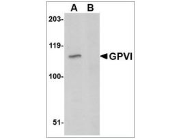 Anti-GPVI (ab1) antibody produced in rabbitaffinity isolated antibody, buffered aqueous solution