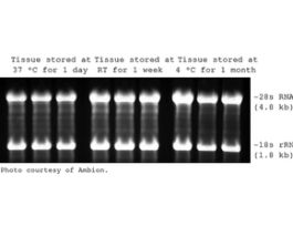 RNAlater(R)Stabilize and protect RNA with immediate RNase inactivation 500ML