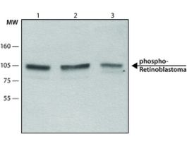Monoclonal Anti-phospho-Retinoblastoma (pSer795) antibody produced in mouse~2 mg/mL, clone RB-10, purified immunoglobulin, buffered aqueous solution