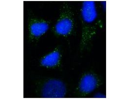 Monoclonal Anti-Rab7 antibody produced in mouse~2 mg/mL, clone Rab7-117, purified immunoglobulin, buffered aqueous solution 200UL