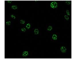 Monoclonal Anti-Splicing Factor SC-35 antibody produced in mouseclone SC-35, ascites fluid .2ML