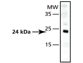 Anti-Superoxide Dismutase (MnSOD) (DD-17) antibody produced in rabbitaffinity isolated antibody, buffered aqueous solution