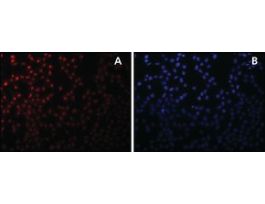 Anti-Sirt7 antibody produced in rabbitaffinity isolated antibody, buffered aqueous solution