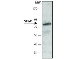 Anti-STIM1 (N-terminal) antibody produced in rabbit~1 mg/mL, affinity isolated antibody, buffered aqueous solution 100UL