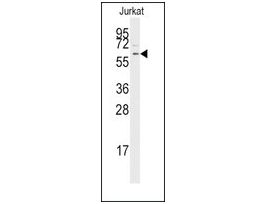 Anti-TGFBR1 (center) antibody produced in rabbitIgG fraction of antiserum, buffered aqueous solution