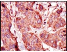 Anti-PFKP (C-term) antibody produced in rabbitIgG fraction of antiserum, buffered aqueous solution