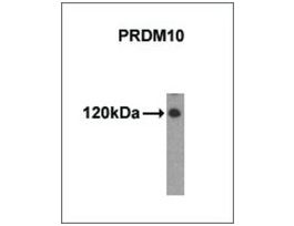 Monoclonal Anti-PRDM10 antibody produced in mousepurified immunoglobulin, buffered aqueous solution