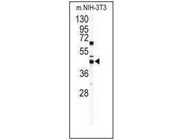 Anti-SUV39H2 (C-term K375) antibody produced in rabbitsaturated ammonium sulfate (SAS) precipitated, buffered aqueous solution