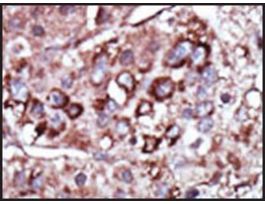 Anti-DGKZ (C-term) antibody produced in rabbitIgG fraction of antiserum, buffered aqueous solution