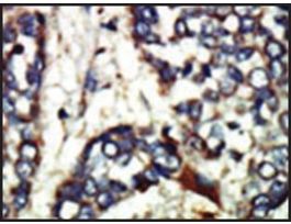 Anti-NEK1 (C-term) antibody produced in rabbitIgG fraction of antiserum, buffered aqueous solution