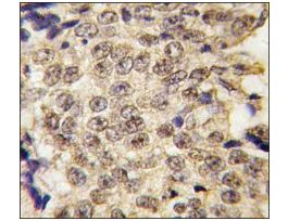 Anti-SMCY (C-term) antibody produced in rabbitsaturated ammonium sulfate (SAS) precipitated, buffered aqueous solution