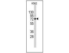 Anti-DDX4 (N-term) antibody produced in rabbitsaturated ammonium sulfate (SAS) precipitated, buffered aqueous solution