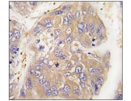 Anti-ARHGEF9 (center) antibody produced in rabbitaffinity isolated antibody, buffered aqueous solution