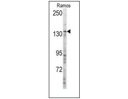 Anti-MSH3 (center) antibody produced in rabbitsaturated ammonium sulfate (SAS) precipitated, buffered aqueous solution