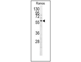 Anti-MEN1 (T594) antibody produced in rabbitIgG fraction of antiserum, buffered aqueous solution