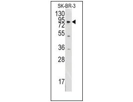 Anti-MCK10 antibody produced in rabbitsaturated ammonium sulfate (SAS) precipitated, buffered aqueous solution