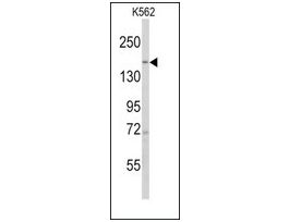 Anti-PHLPP1 (N-term) antibody produced in rabbitsaturated ammonium sulfate (SAS) precipitated, buffered aqueous solution