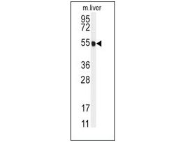 Anti-CYP2R1 (center) antibody produced in rabbitsaturated ammonium sulfate (SAS) precipitated, buffered aqueous solution