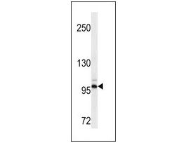 MONOCLONAL ANTI-DDR2 antibody produced in mouseclone, crude ascites, buffered aqueous solution