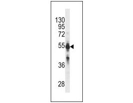 MONOCLONAL ANTI-CYP2C9 (N-TERMINAL) antibody produced in mouseclone, crude ascites, buffered aqueous solution