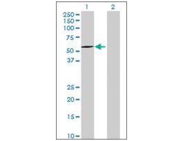 Anti-ALDH7A1 antibody produced in mouseIgG fraction of antiserum, buffered aqueous solution