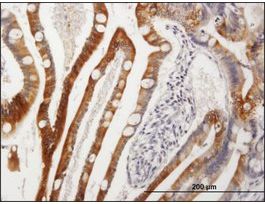 Anti-CYP3A4 antibody produced in mouseIgG fraction of antiserum, buffered aqueous solution