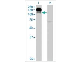 Anti-ENPP1 antibody produced in mouseIgG fraction of antiserum, buffered aqueous solution