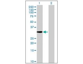 Anti-ACBD6 antibody produced in mouseIgG fraction of antiserum, buffered aqueous solution