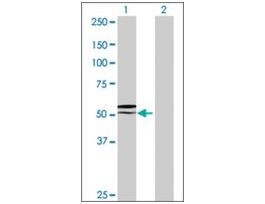 Anti-GGT6 antibody produced in mouseIgG fraction of antiserum, buffered aqueous solution